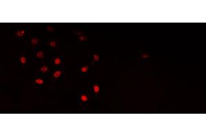 ABIN6276759 staining HepG2? (ELAVL1 antibody  (Internal Region))