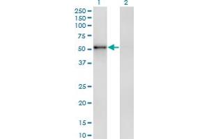 Western Blot analysis of ZNF207 expression in transfected 293T cell line by ZNF207 monoclonal antibody (M04), clone 8G7. (ZNF207 antibody  (AA 1-110))