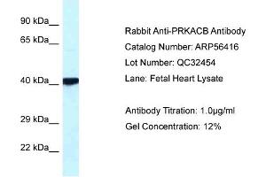 WB Suggested Anti-PRKACB Antibody Titration: 0. (PRKACB antibody  (Middle Region))