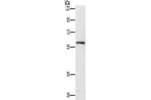 Gel: 8 % SDS-PAGE, Lysate: 40 μg, Lane: Mouse spleen tissue, Primary antibody: ABIN7131459(TRAFD1 Antibody) at dilution 1/400, Secondary antibody: Goat anti rabbit IgG at 1/8000 dilution, Exposure time: 4 minutes (TRAFD1 antibody)