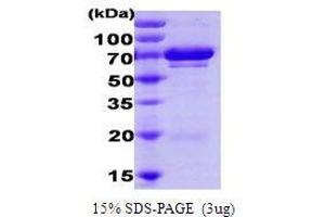 Figure annotation denotes ug of protein loaded and % gel used. (UBE2G1 Protein)