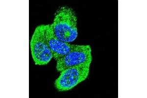 Confocal immunofluorescent analysis of H-RAS antibody with MCF-7 cells followed by Alexa Fluor 488-conjugated goat anti-rabbit lgG (green). (HRAS antibody  (AA 146-176))