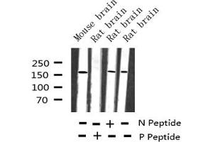 Western blot analysis of Phospho-IRS-1 (Ser636) expression in various lysates (IRS1 antibody  (pSer636))