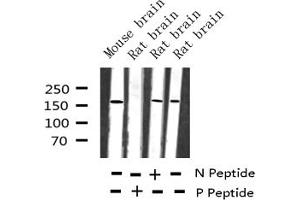 IRS1 antibody  (pSer636)