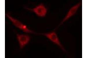 ABIN6274237 staining HeLa cells by IF/ICC. (GRK5 antibody  (Internal Region))
