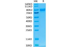 Human SIRP alpha V2/CD172a on Tris-Bis PAGE under reduced condition. (SIRP AlphaV2 protein (Fc Tag))