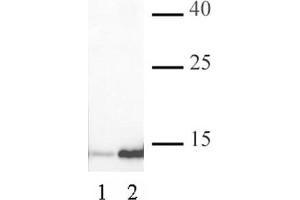 Histone H3K4ac antibody (pAb) tested by Western blot. (Histone 3 antibody  (acLys4))