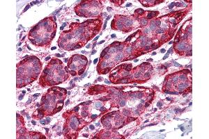 Anti-THRA antibody IHC of human breast. (THRA antibody  (AA 147-158))
