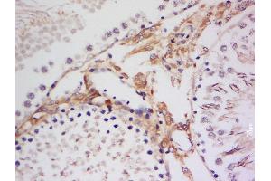 Formalin-fixed and paraffin embedded rat testis labeled with Anti-p90RSK1 (Thr359 + Ser363) Polyclonal Antibody, Unconjugated  at 1:300 followed by conjugation to the secondary antibody and DAB staining. (RPS6KA3 antibody  (pSer363, pThr359))