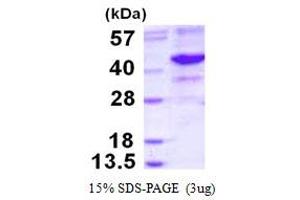 Image no. 1 for Endonuclease 8-like 2 (NEIL2) protein (His tag) (ABIN1098272)
