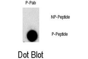 Dot blot analysis of FGFR1 (phospho Y307) polyclonal antibody  on nitrocellulose membrane.