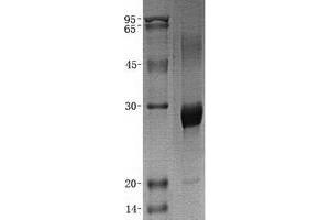 Validation with Western Blot (EPT1 Protein (His tag))