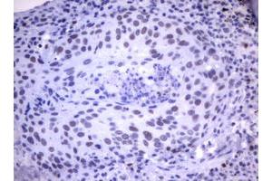 Image no. 1 for anti-Mdm2, p53 E3 Ubiquitin Protein Ligase Homolog (Mouse) (MDM2) (AA 119-438) antibody (ABIN1490872) (MDM2 antibody  (AA 119-438))