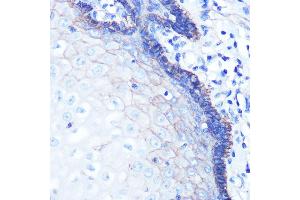 Immunohistochemistry (IHC) image for anti-Sodium Potassium ATPase, alpha1 (ATP1A1) antibody (ABIN7270390)