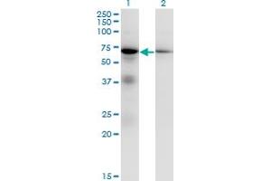 Western Blotting (WB) image for anti-Eukaryotic Translation Initiation Factor 2-alpha Kinase 2 (EIF2AK2) (AA 1-100) antibody (ABIN562440)