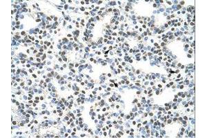 Image no. 1 for anti-A Kinase (PRKA) Anchor Protein 8-Like (AKAP8L) (C-Term) antibody (ABIN202849) (AKAP8L antibody  (C-Term))