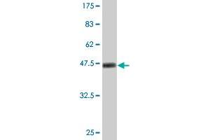 Western Blot detection against Immunogen (47. (Ube2t antibody  (AA 1-197))