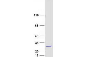 Validation with Western Blot
