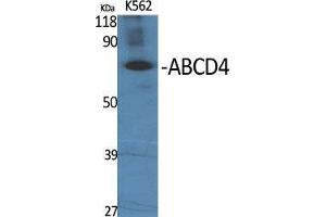 Western Blot (WB) analysis of specific cells using ABCD4 Polyclonal Antibody. (ABCD4 antibody  (Internal Region))