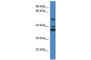 Western Blot showing RTN4IP1 antibody used at a concentration of 1 ug/ml against Fetal Kidney Lysate (RTN4IP1 antibody  (Middle Region))