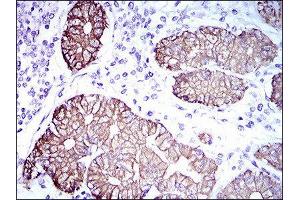 Immunohistochemistry (IHC) image for anti-Keratin 5 (KRT5) (AA 316-590) antibody (ABIN1845567) (Cytokeratin 5 antibody  (AA 316-590))