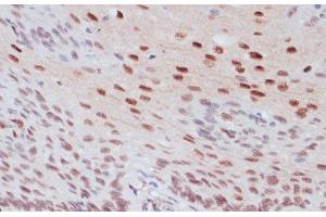 Immunohistochemistry of paraffin-embedded Human esophageal using Phospho-CREB1(S133) Polyclonal Antibody at dilution of 1:100 (40x lens). (CREB1 antibody  (pSer133))