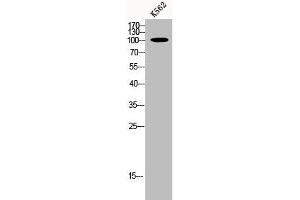 Western Blot analysis of K562 cells using p115 Polyclonal Antibody (USO1 antibody  (C-Term))