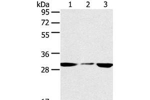 Western Blot analysis of PC3 and hepg2 cell, Human fetal liver tissue using SDHB Polyclonal Antibody at dilution of 1:400 (SDHB antibody)