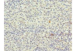 Immunohistochemistry (IHC) image for anti-Cyclin-Dependent Kinase Inhibitor 2D (p19, Inhibits CDK4) (CDKN2D) (AA 1-166) antibody (ABIN7148893)