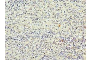 Immunohistochemistry of paraffin-embedded human spleen tissue using ABIN7148893 at dilution of 1:100 (CDKN2D antibody  (AA 1-166))