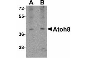 Image no. 1 for anti-Atonal Homolog 8 (ATOH8) (C-Term) antibody (ABIN478063) (ATOH8 antibody  (C-Term))