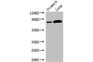 Western Blot Positive WB detected in: Mouse stomach tissue, Rat lung tissue All lanes: SLC3A1 antibody at 2. (SLC3A1 antibody  (AA 1-68))