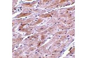 Immunohistochemistry (IHC) image for anti-Transient Receptor Potential Cation Channel, Subfamily C, Member 3 (TRPC3) (N-Term) antibody (ABIN1031644) (TRPC3 antibody  (N-Term))