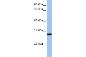 WB Suggested Anti-VDAC3 Antibody Titration: 0. (VDAC3 antibody  (N-Term))
