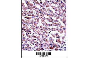 GDI2 Antibody immunohistochemistry analysis in formalin fixed and paraffin embedded human liver tissue followed by peroxidase conjugation of the secondary antibody and DAB staining. (GDI2 antibody  (AA 135-164))