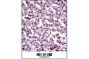 GDI2 Antibody immunohistochemistry analysis in formalin fixed and paraffin embedded human liver tissue followed by peroxidase conjugation of the secondary antibody and DAB staining.
