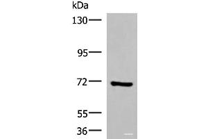 Western blot analysis of HepG2 cell lysate using PAPSS2 Polyclonal Antibody at dilution of 1:1000 (PAPSS2 antibody)