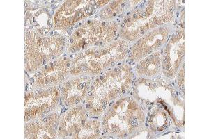 ABIN6266508 at 1/200 staining human kidney tissue sections by IHC-P. (Claudin 2 antibody  (C-Term))