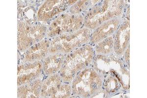 ABIN6266508 at 1/200 staining human kidney tissue sections by IHC-P. (Claudin 2 antibody  (C-Term))