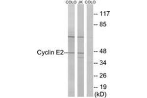 Western blot analysis of extracts from COLO/Jurkat cells, using Cyclin E2 (Ab-392) Antibody. (Cyclin E2 antibody  (AA 355-404))