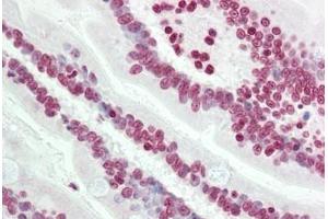 Human Small Intestine: Formalin-Fixed, Paraffin-Embedded (FFPE)