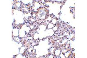 Immunohistochemistry of TRPC6 in mouse lung tissue with TRPC6 polyclonal antibody  at 10 ug/mL . (TRPC6 antibody  (N-Term))