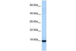 Image no. 1 for anti-Inhibitor of DNA Binding 3, Dominant Negative Helix-Loop-Helix Protein (ID3) (AA 58-107) antibody (ABIN6748024) (ID3 antibody  (AA 58-107))