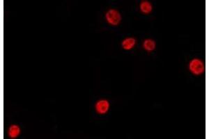 ABIN6275444 staining LOVO by IF/ICC. (RANBP6 antibody  (Internal Region))