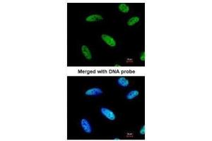 ICC/IF Image Immunofluorescence analysis of paraformaldehyde-fixed HeLa, using DNAJC7, antibody at 1:200 dilution. (DNAJC7 antibody  (Center))