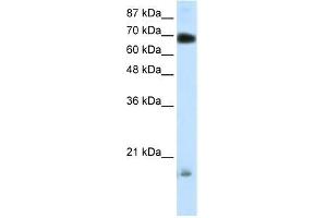 Human 293T; WB Suggested Anti-TRIM32 Antibody Titration: 0. (TRIM32 antibody  (C-Term))