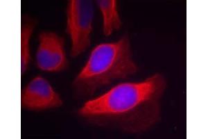 Immunofluorescence staining of methanol-fixed HeLa cells using IKK-β (Phospho-Tyr199) Antibody (E011305, Red) (IKBKB antibody  (pTyr199))