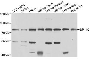Western blot analysis of extracts of various cell lines, using SP110 antibody (ABIN4905277) at 1:1000 dilution. (SP110 antibody)