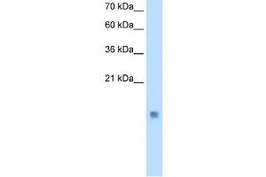 Cystatin B antibody used at 0. (CSTB antibody)