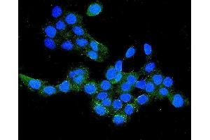 IF analysis of CLDN16/Claudin-16 using anti-CLDN16/Claudin-16 antibody (ABIN7602819). (Claudin 16 antibody  (C-Term))